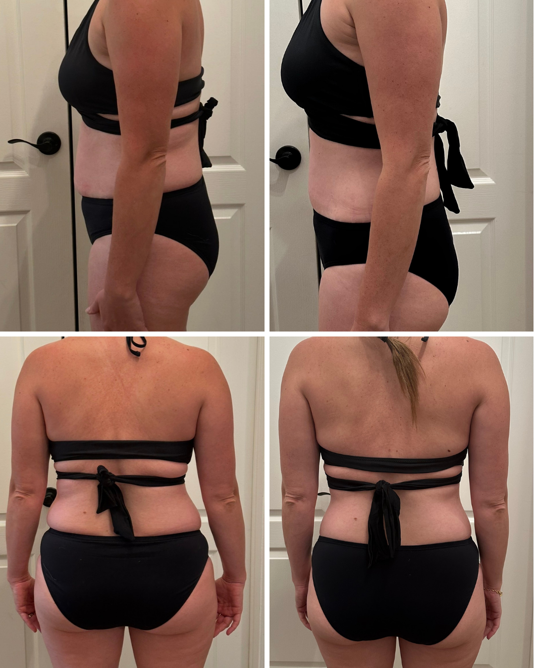 Before and After Side View