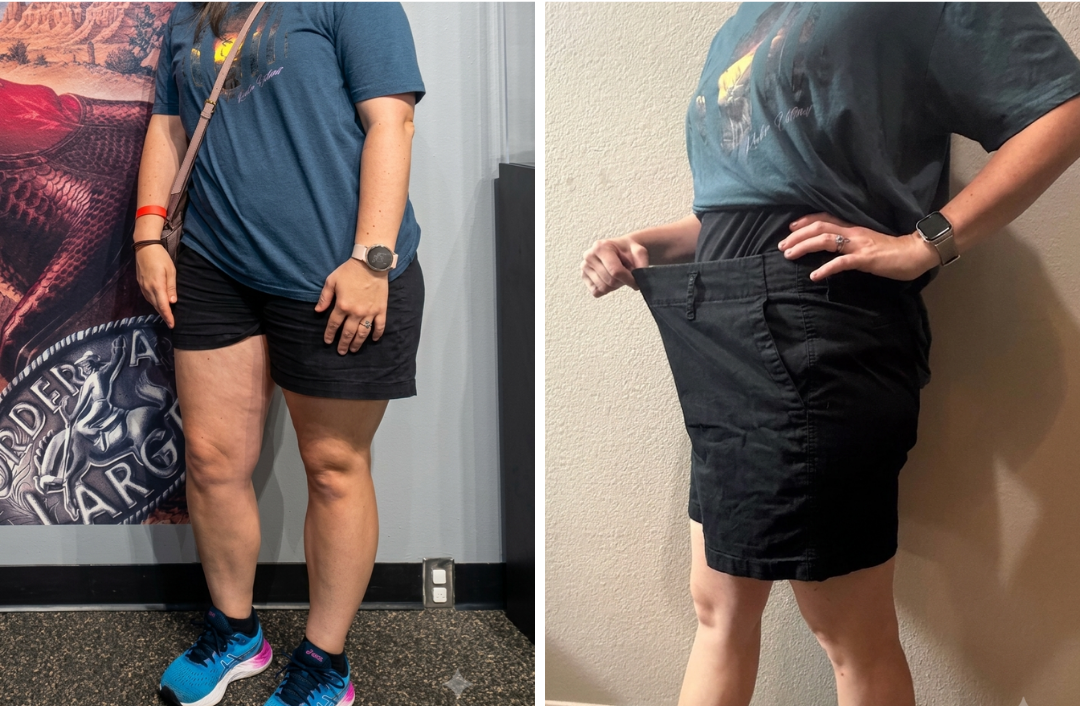 Before and After Back View