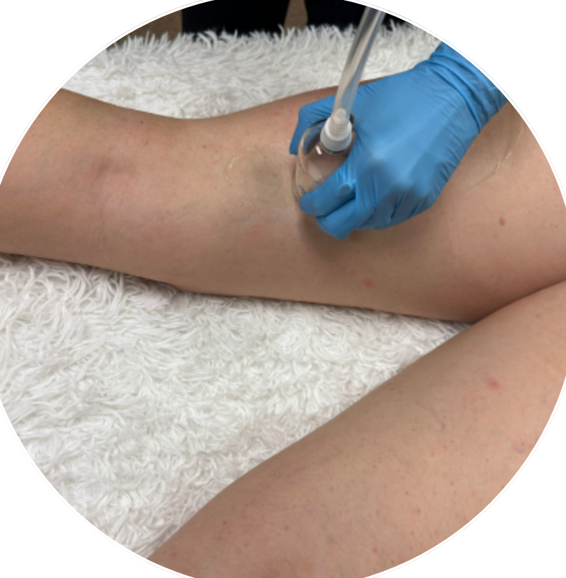 Sculpt and Cellulite Add-On Session