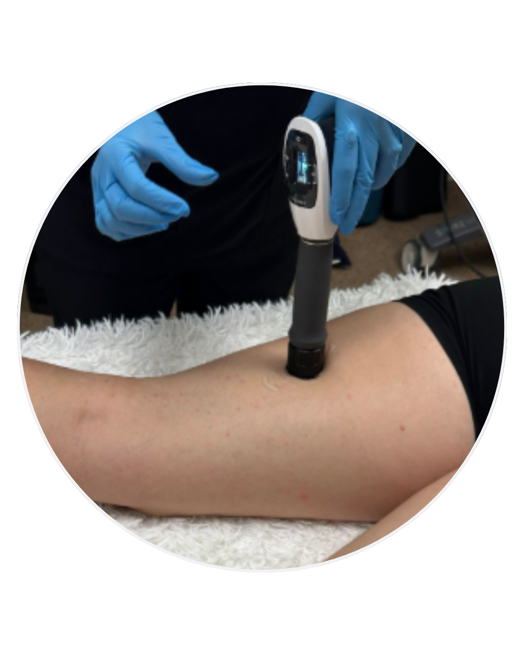 Shockwave Therapy
