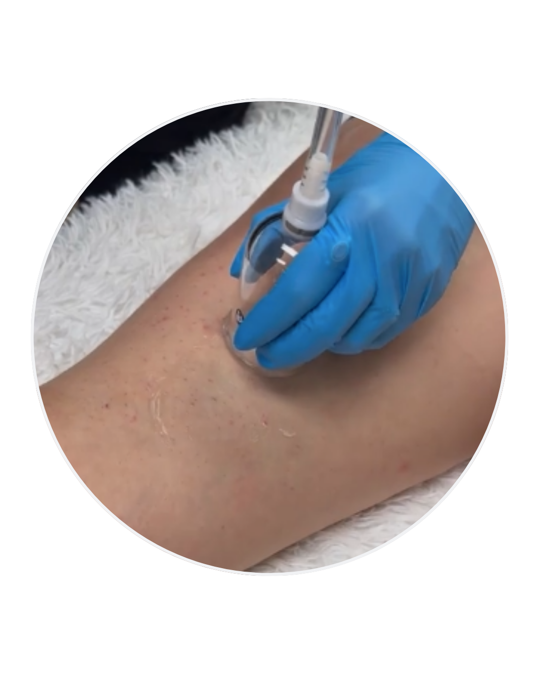 Matrix Detox & Regeneration