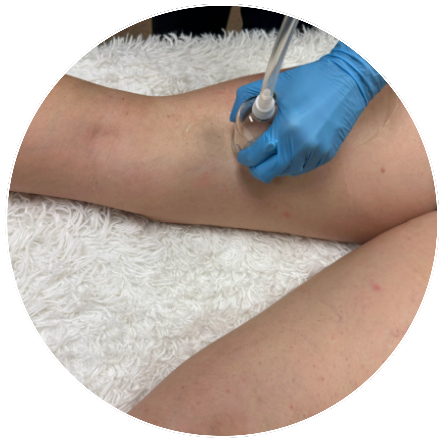 Sculpt and Cellulite Add-On